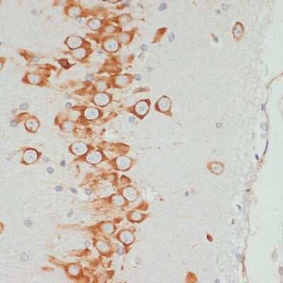 Immunohistochemistry-Paraffin: VASP [p Ser157] Antibody - Azide and BSA Free [NBP3-05448]